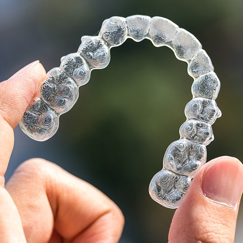 Angel aligners Ossa Orthodontics in Caldwell, OH